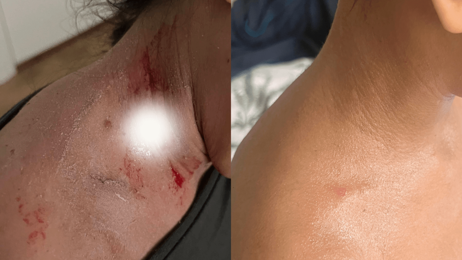 مرهم تامو العضوي لإنقاذ الأكزيما