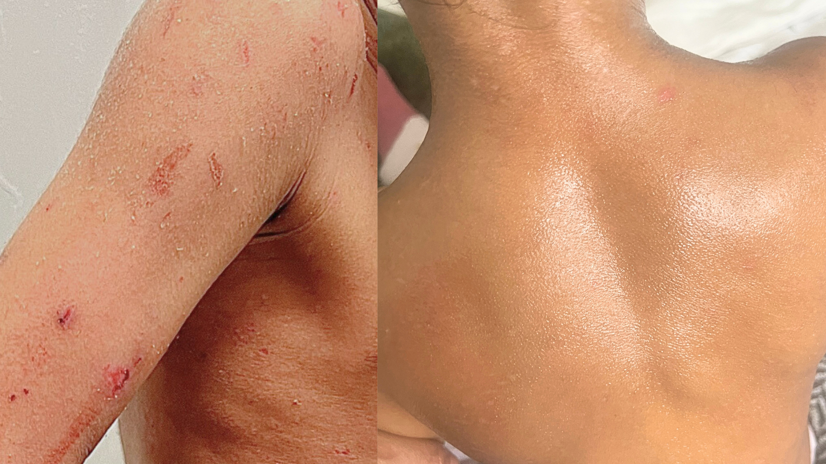 مرهم تامو العضوي لإنقاذ الأكزيما