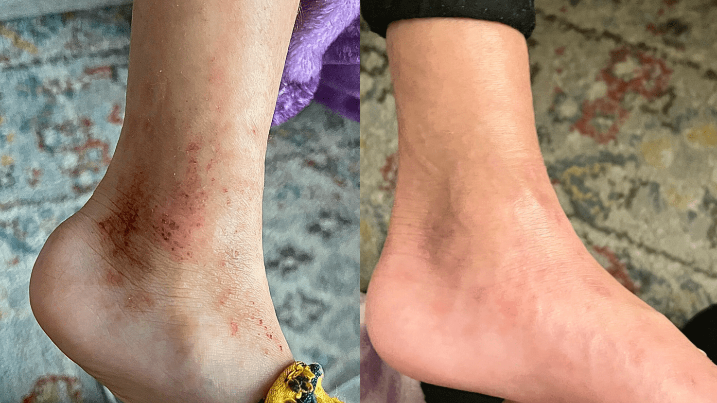 مرهم تامو العضوي لإنقاذ الأكزيما