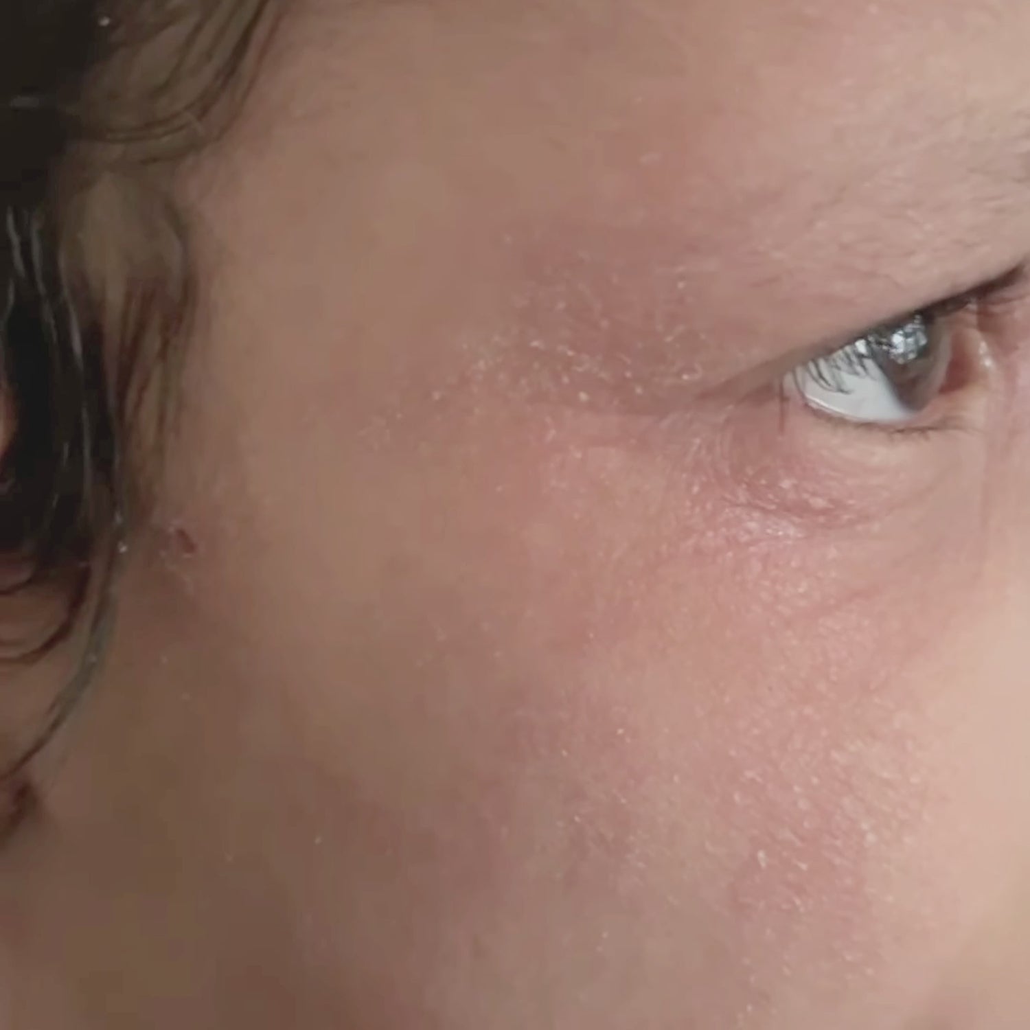 مرهم تامو العضوي لإنقاذ الأكزيما