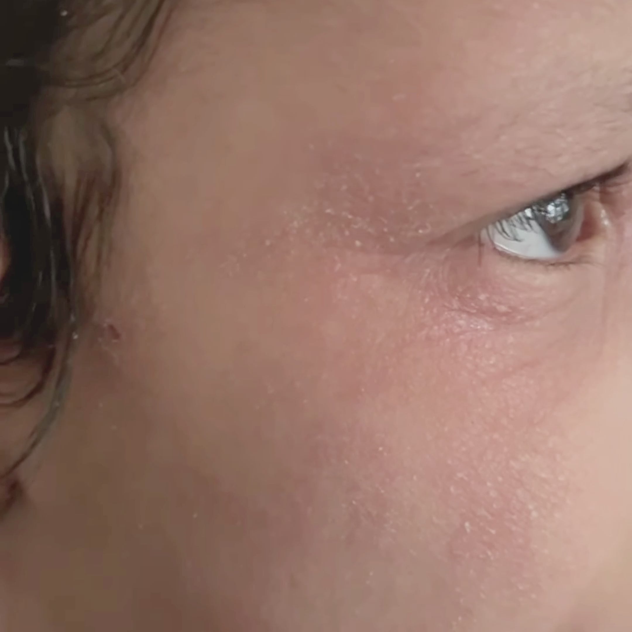 مرهم تامو العضوي لإنقاذ الأكزيما