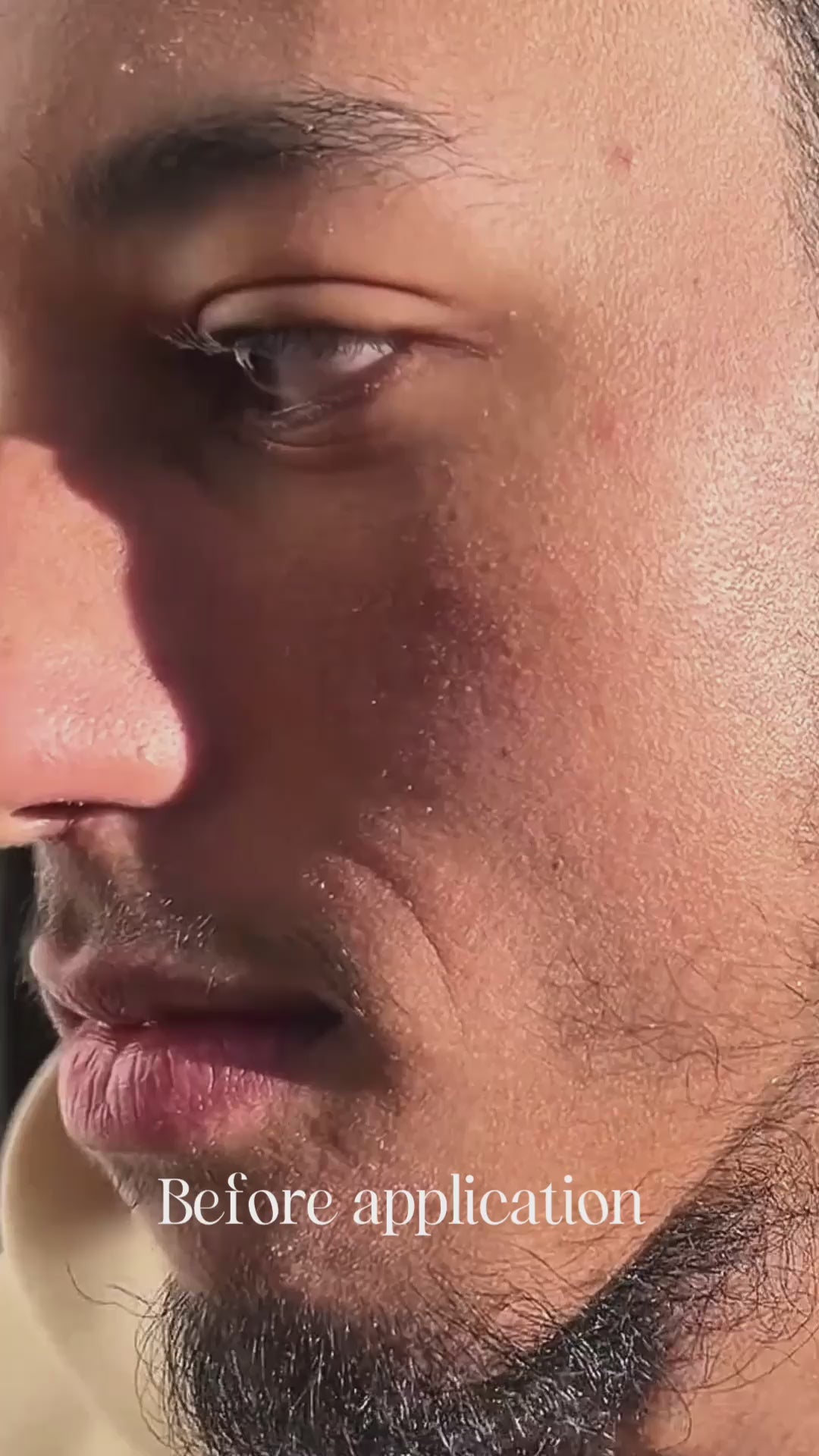 مرهم تامو العضوي لإنقاذ الأكزيما