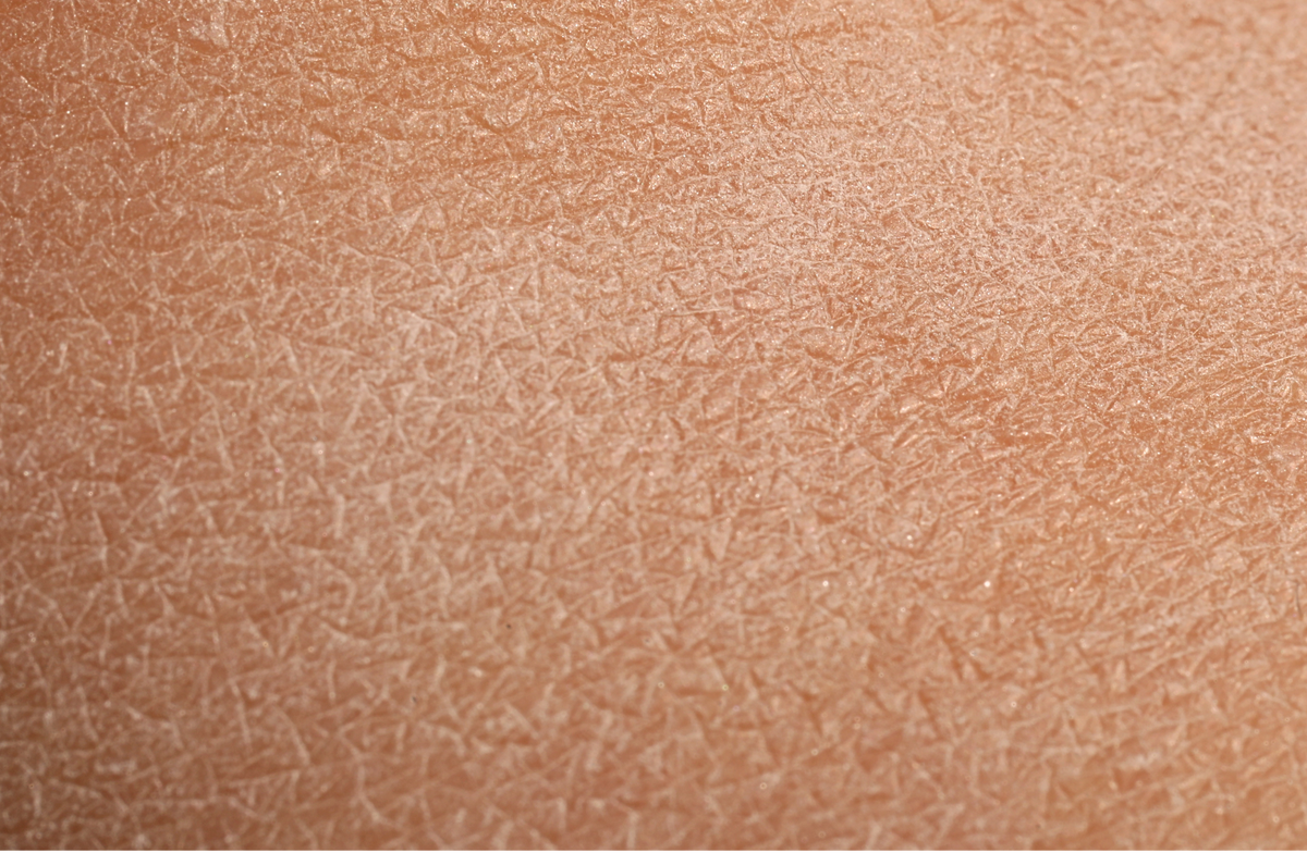 Dry skin