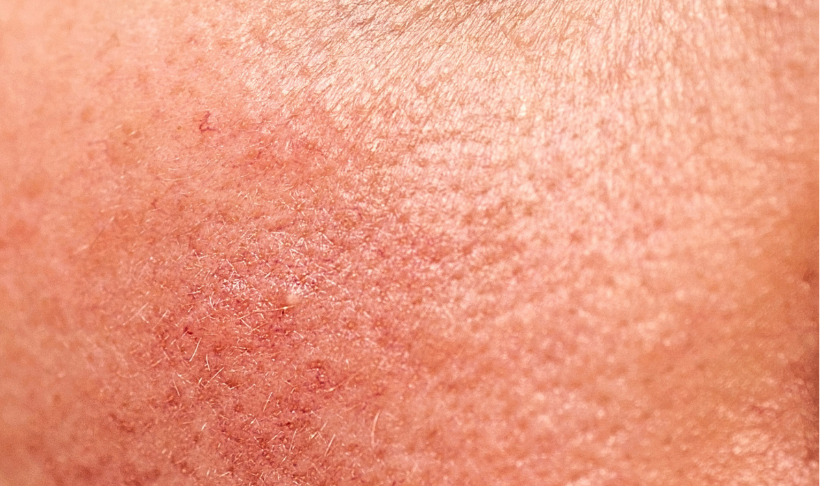 Pores &amp; texture