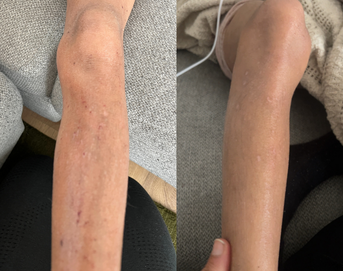 Eczema skin comfort duo